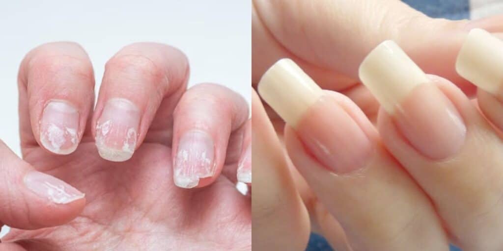 unhas fracas como cuidados diarios